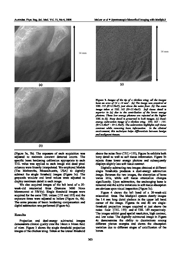 Download Spectroscopic biomedical imaging with the Medipix2 detector.